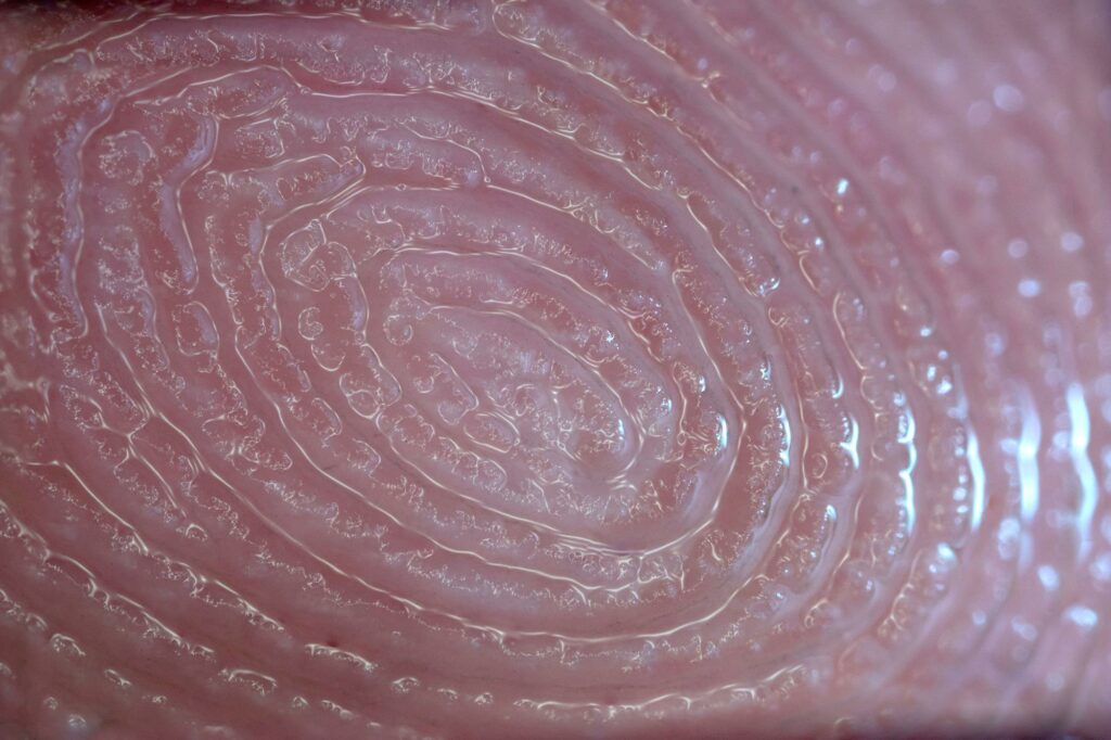 عرق نوک انگشت می‌تواند شیوه مصرف دارو توسط بیماران را نشان دهد