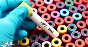 افزایش ابتلا و مرگ‌ومیر سرطان زنان در آسیا و اقیانوسیه نگران‌کننده است