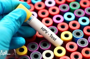 افزایش ابتلا و مرگ‌ومیر سرطان زنان در آسیا و اقیانوسیه نگران‌کننده است