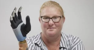 این دست بیونیکی سیگنال‌های مغز را به حرکات دقیق تبدیل می‌کند + ویدیو