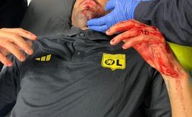 عکس| بازیکن خاطره ساز آبی ها با سنگ مورد حمله قرار گرفت