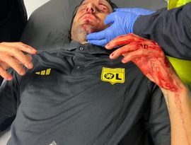 عکس| بازیکن خاطره ساز آبی ها با سنگ مورد حمله قرار گرفت