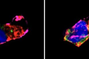 کمتر از 7 ساعت خواب شبانه احتمال بیماری قلبی را افزایش می‌دهد
