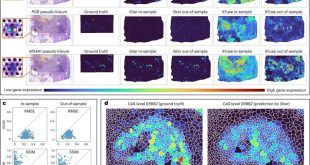این ابزار هوش مصنوعی جدید ظاهراً می‌تواند دقیق‌تر و سریع‌تر سرطان‌ را تشخیص دهد