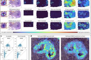 این ابزار هوش مصنوعی جدید ظاهراً می‌تواند دقیق‌تر و سریع‌تر سرطان‌ را تشخیص دهد