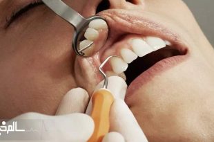 ۵۰ درصد از ایرانی ها دچار بیماری‌های دهان و دندان هستند