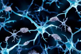 ابداع اسپری بینی جدیدی برای پیشگیری از ابتلا به بیماری آلزایمر