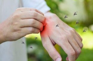 اسپری پیشگیری از گزش پشه کمیاب نیست