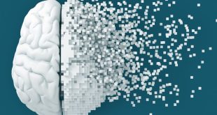 سلول‌های پشتیبان مغز ممکن است به آلزایمر دامن بزنند