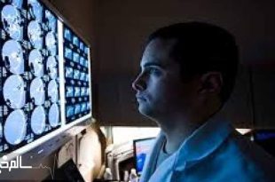 تا ۵ سال آینده نیاز به ۳۵۰ جراح مغز و اعصاب در کشور داریم