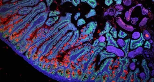 پژوهشی جدید در حوزه پوست می‌تواند به کاهش سرعت علائم پیری کمک کند