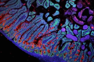 پژوهشی جدید در حوزه پوست می‌تواند به کاهش سرعت علائم پیری کمک کند