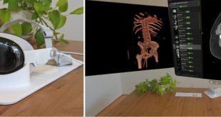 کاربرد ویژن پرو در رادیولوژی