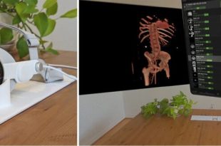 کاربرد ویژن پرو در رادیولوژی