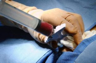 عمل پیوند سلول بنیادی آلوژن مغز استخوان اصفهان انجام شد