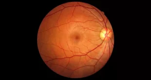 رگ‌های چشم شاید بتواند به تشخیص زودهنگام زوال عقل کمک کند