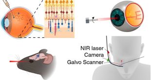 تزریق طلا به چشم برای درمان نابینایی