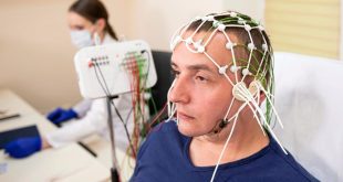 الکترود شبیه به مو