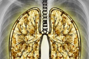 ویپ‌ها برای جوانان ریه پاپ‌کورنی هدیه می‌آورند!