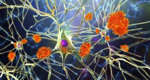 چرا بیماری‌ها بر زنان و مردان اثر متفاوتی دارند؟ تحقیق جدید پاسخ می‌دهد