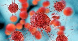 داروی جدید آسترازنکا برای درمان سرطان سینه