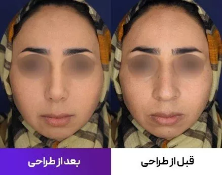 1753269458 628 همانند‌سازی عمل بینی با هوش مصنوعی دلچسب.webp