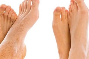 لیزر موهای زائد هونام تجهیز