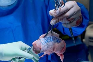 آغاز دوره‌ای تازه در پیوند اعضا؛ FDA مجوز کارآزمایی کلیه‌ ویرایش‌شده ژنتیکی خوک را صادر کرد