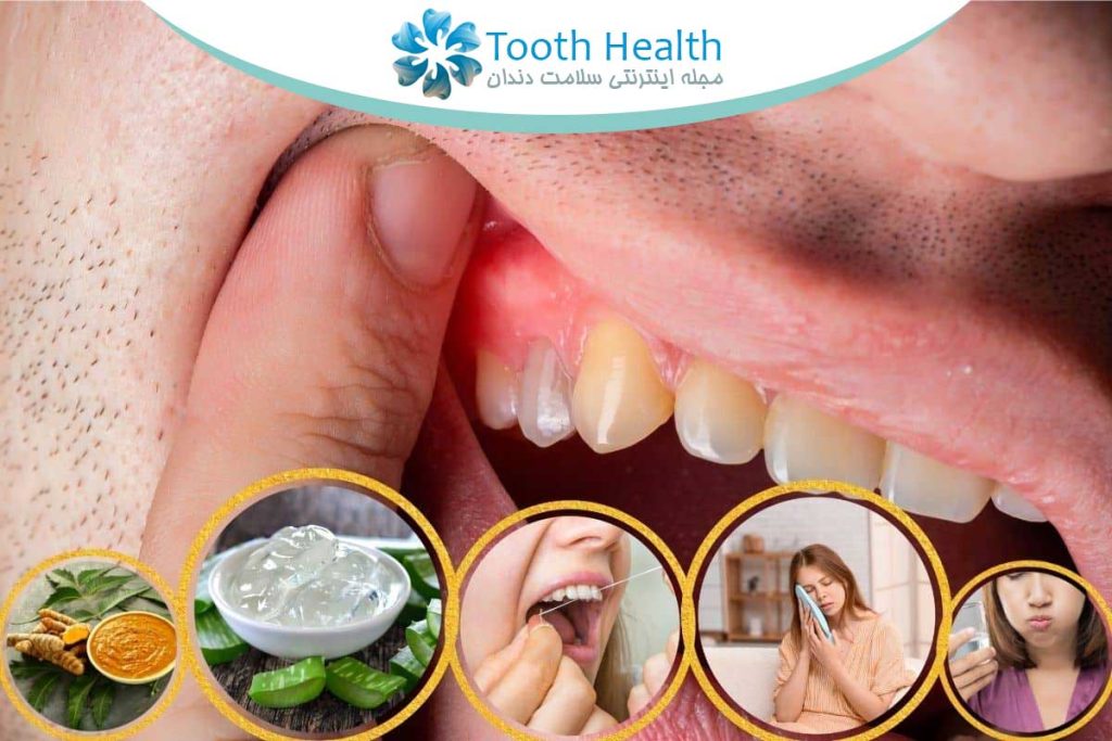 لبخندی که همه چیز رو تغییر میده؛ راهنمای کامل مراقبت و درمان های دندانپزشکی 7 لبخندی که همه چیز رو تغییر میده؛ راهنمای کامل مراقبت و درمان های دندانپزشکی