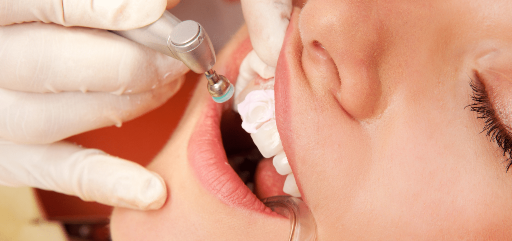 لبخندی که همه چیز رو تغییر میده؛ راهنمای کامل مراقبت و درمان های دندانپزشکی 9 لبخندی که همه چیز رو تغییر میده؛ راهنمای کامل مراقبت و درمان های دندانپزشکی