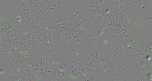 خودکشی سلول‌های سرطانی با باکتری