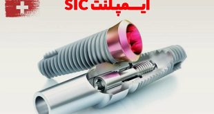 چرا برخی بیماران فقط ایمپلنت سوئیسی SIC را انتخاب می‌کنند؟