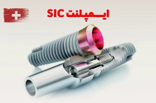 چرا برخی بیماران فقط ایمپلنت سوئیسی SIC را انتخاب می‌کنند؟