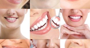 دندانپزشک زیبایی در کرج؛ قبل از اصلاح لبخند این نکات را بدانید
