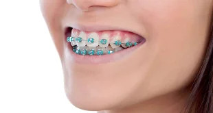 آیا ارتودنسی فقط جنبه زیبایی دارد؟ نگاهی به تأثیر این درمان بر سلامت دهان، فک و کیفیت زندگی