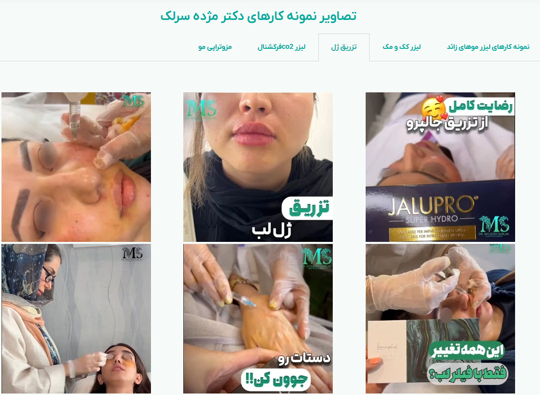 تجربه پزشک در درمان های زیبایی چقدر مهم است؟ 2 نمونه کارهای دکتر مژده سرلک؛متخصص پوست،مو و زیبایی